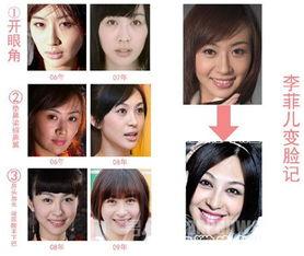 西安整容爆料事件视频最新,揭秘行业乱象，患者权益引关注